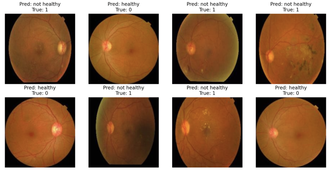 Diabetic retinopathy detection model predictions